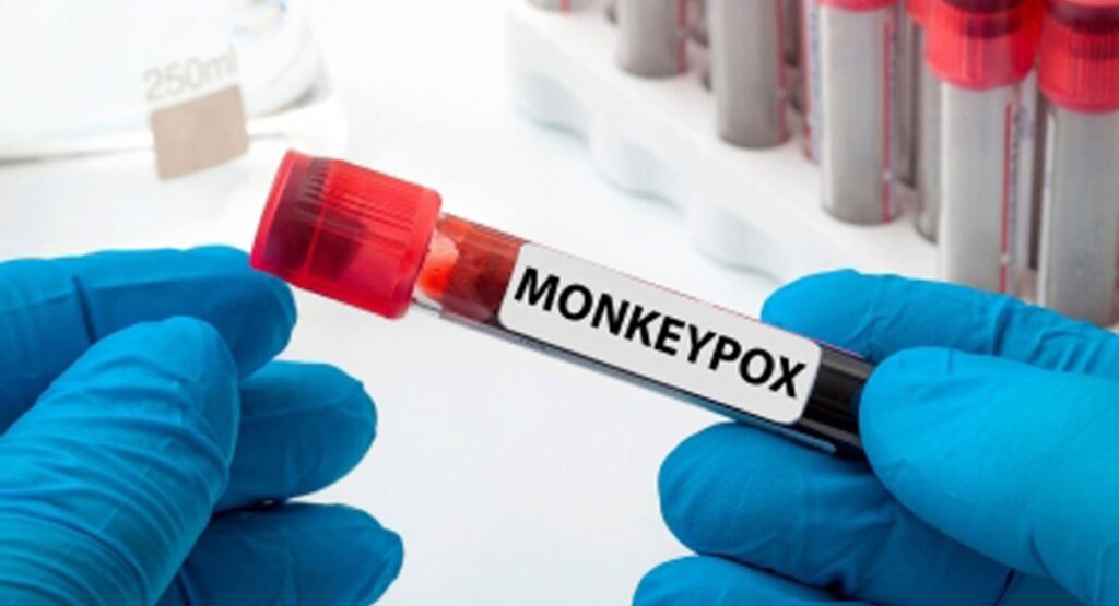 monkeypox death spain europe outbreak mpx